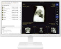 LG 24” 24CK560N-3A All-in-One FHD IPS Thin Client for Medical &amp Healthcare with Fanless &amp Ergonomic Design
