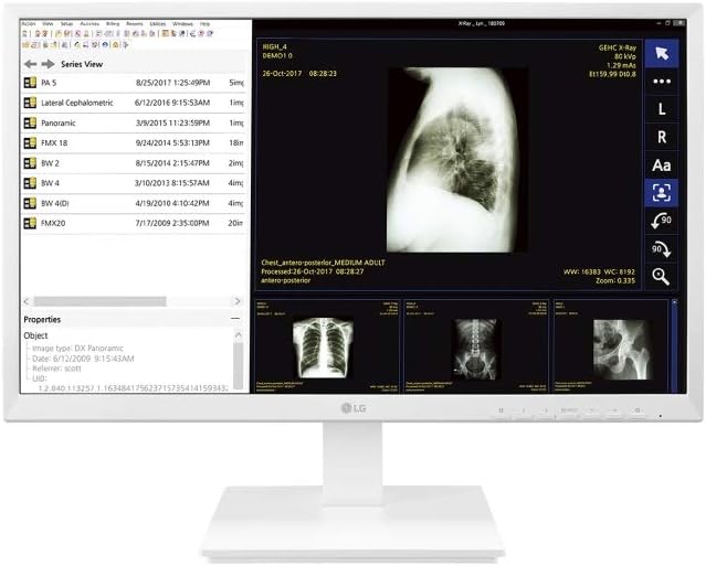 LG 24” 24CK560N-3A All-in-One FHD IPS Thin Client for Medical &amp Healthcare with Fanless &amp Ergonomic Design