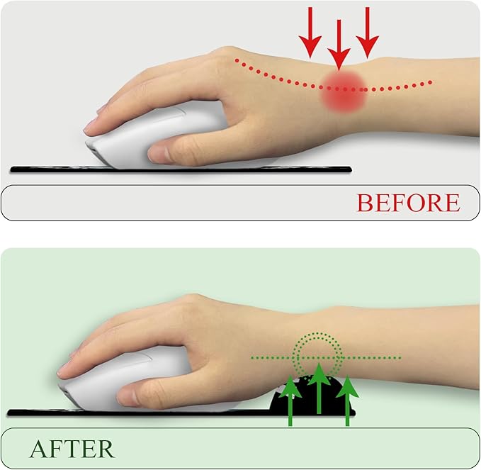 Funny Dog Ergonomic Mouse Pad with Wrist Rest Gaming Large Desk Mat