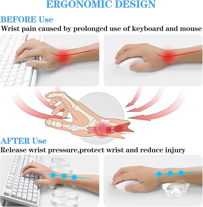 Acrylic Transparent Computer Keyboard Stand with Gel Cloud Keyboard and Mouse Wrist Rest Ergonomic Tilting 3-in-1 Set Relieves Painful Typing for Office/Computer/Laptop/Gaming